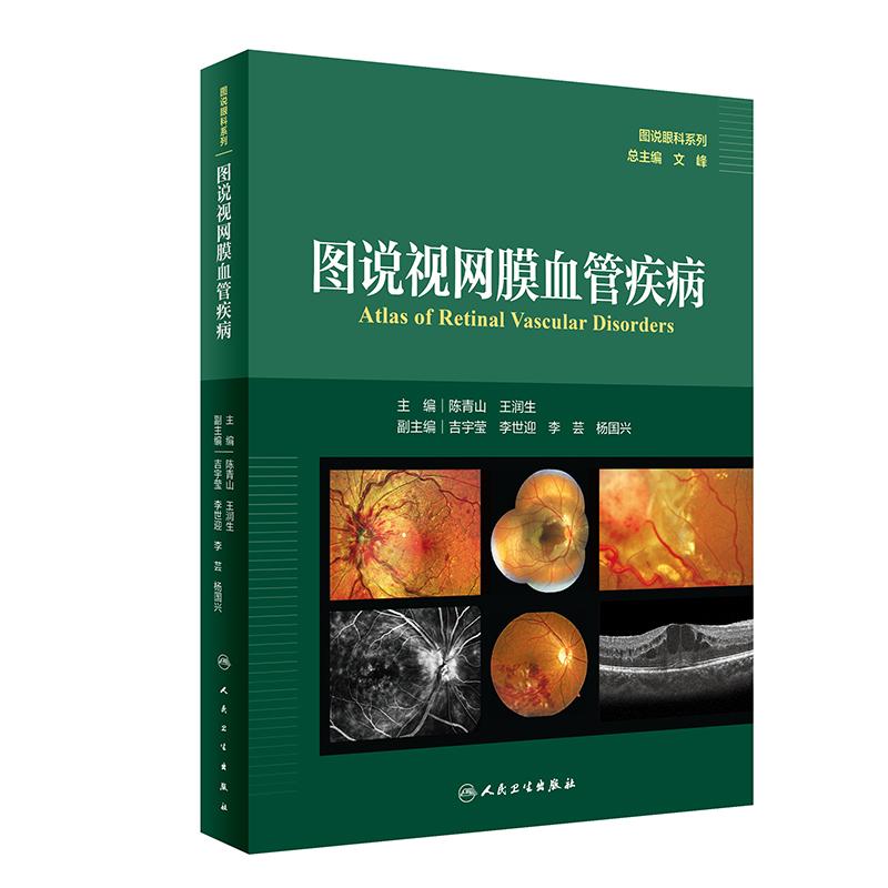 《图说视网膜血管疾病（图说眼科系列）（500） 》